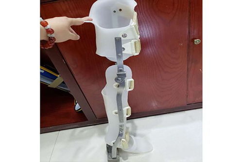 假肢與矯形器的使用周期與更換指南 科學(xué)維護(hù)，保障生活品質(zhì)